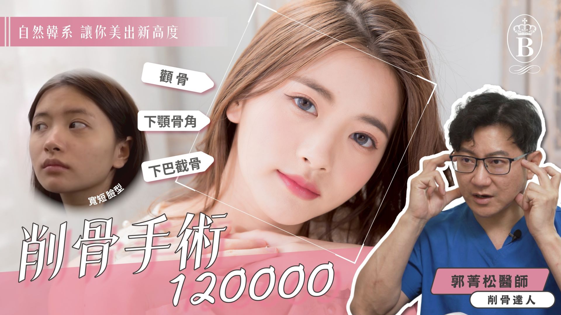 台北削骨手術任一部位120,000 削骨達人郭菁松 削骨手術權威醫師