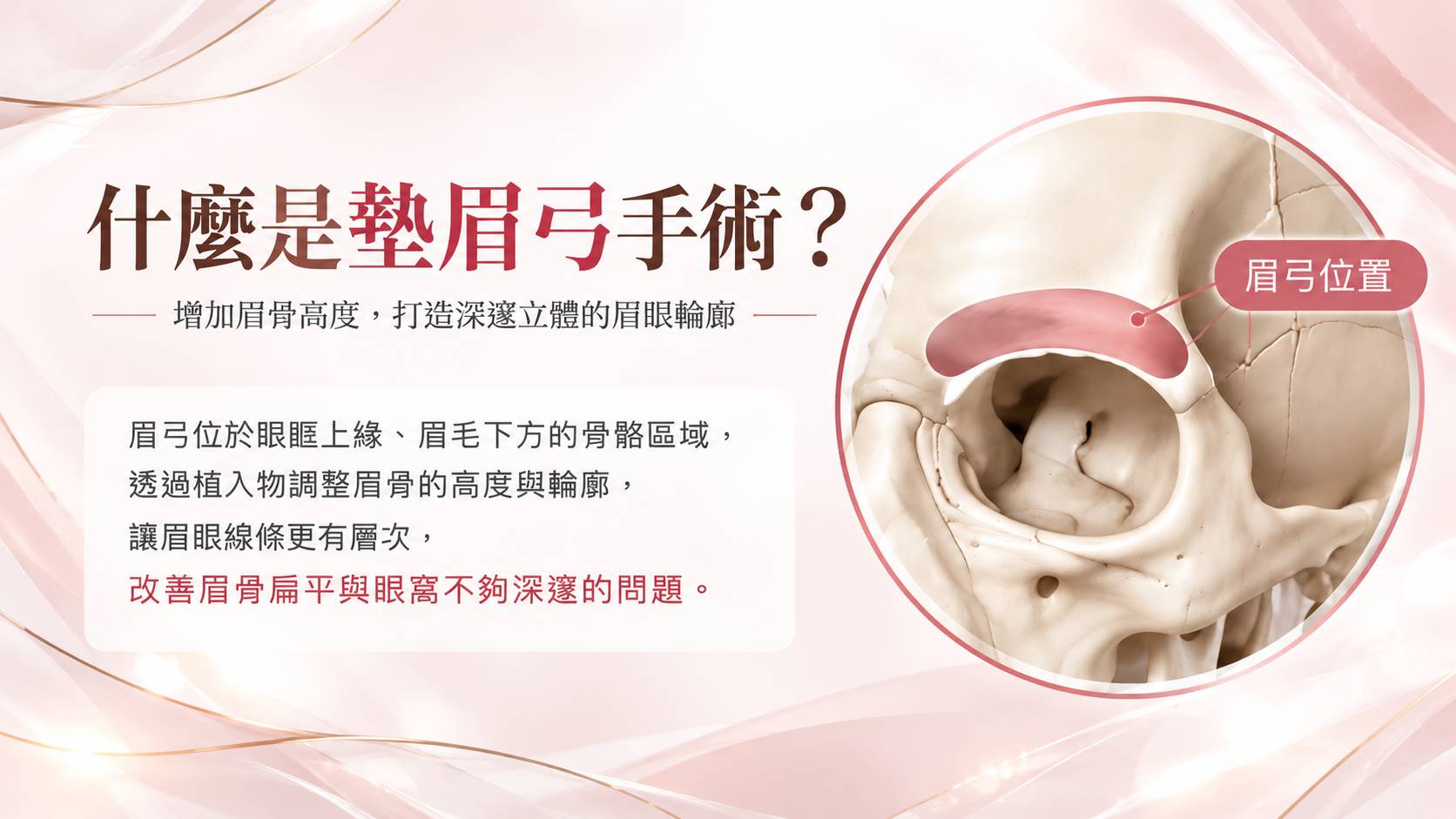 台北墊眉弓手術權威醫師推薦價格費用002