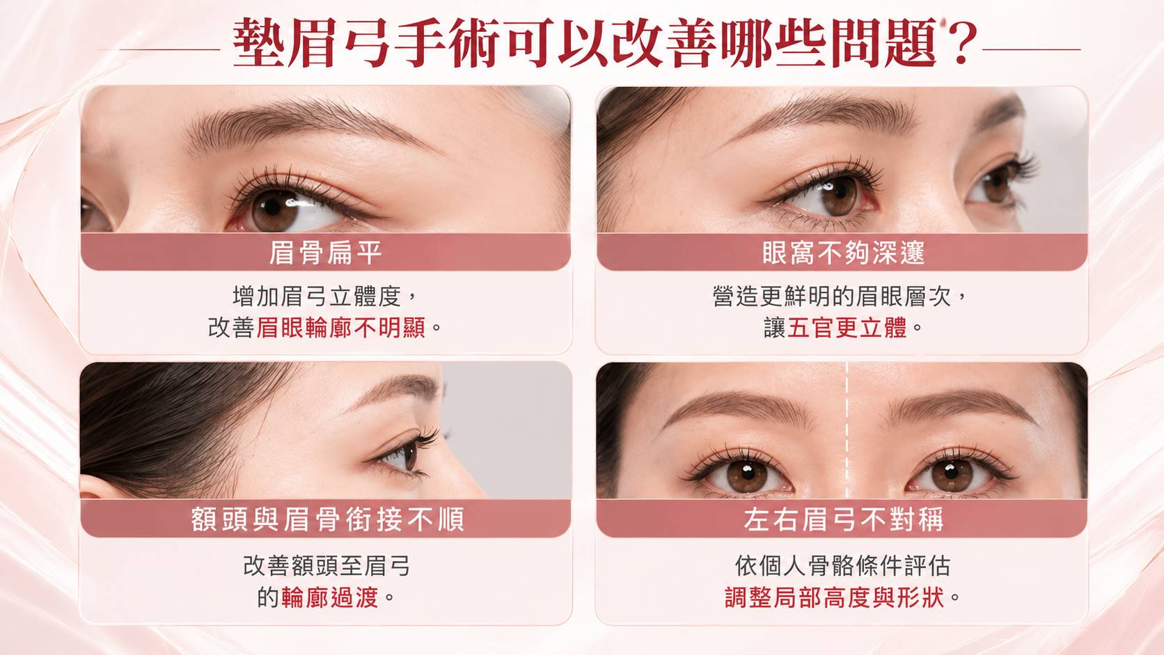 台北墊眉弓手術權威醫師推薦價格費用003