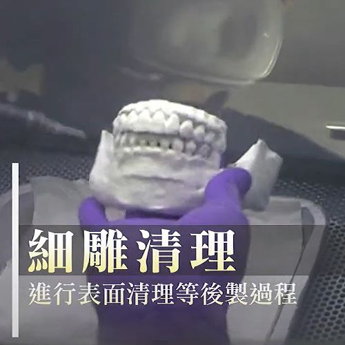 3D列印手術整形醫美的應用介紹，3D列印手術是什麼？  人工骨、骨水泥、Peek、完形美四大材質優缺點大解析