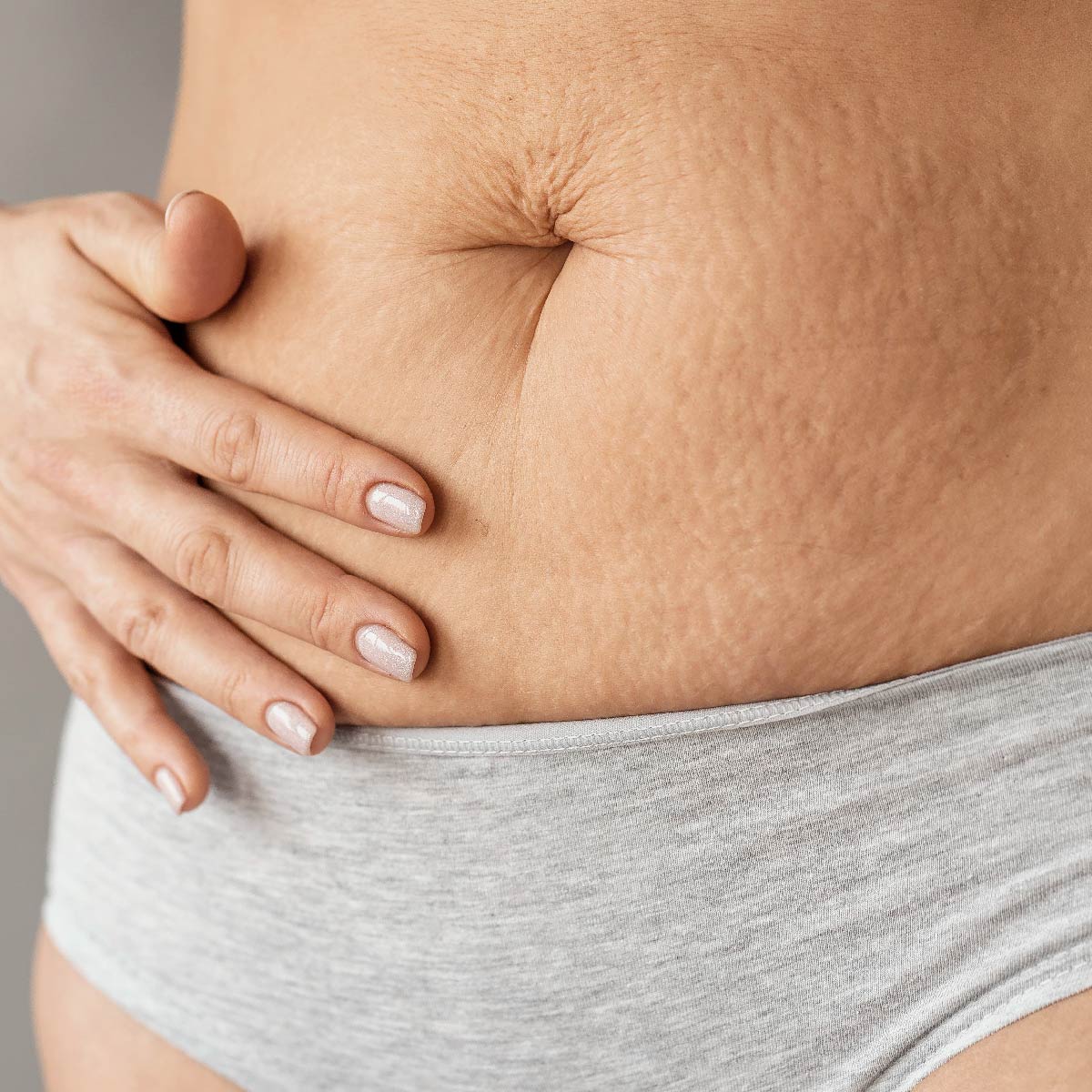 產後媽咪改造 台北教主醫美整形 BishopClinic