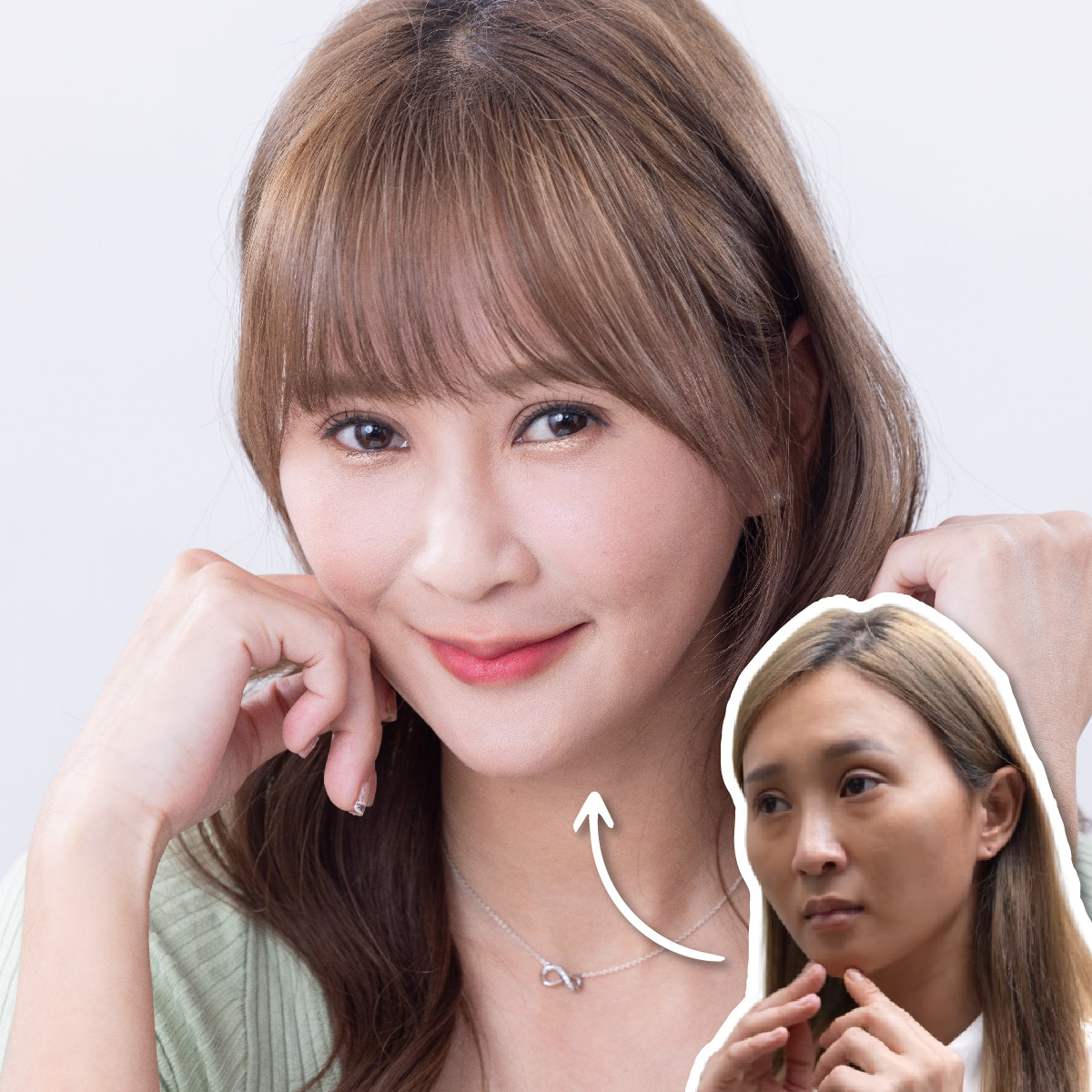 「起床照鏡子都會笑」削骨+墊下巴大變身！連修容都省了？！