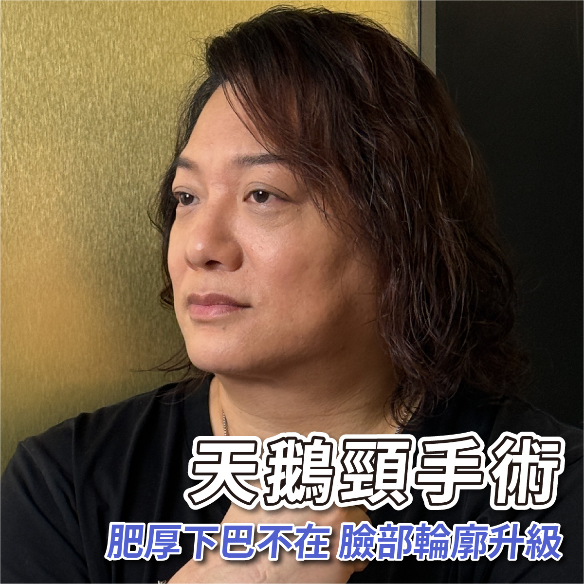 做完這「兩項」後臉部線條大大升級