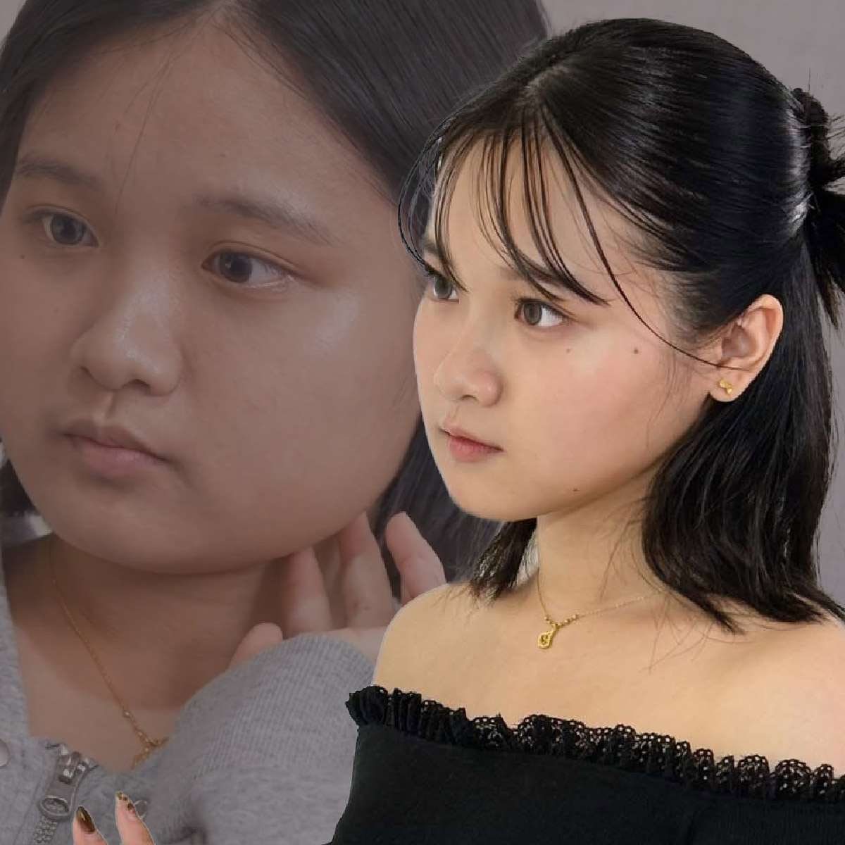 從小被說臉很大？告別「大臉陰影」！