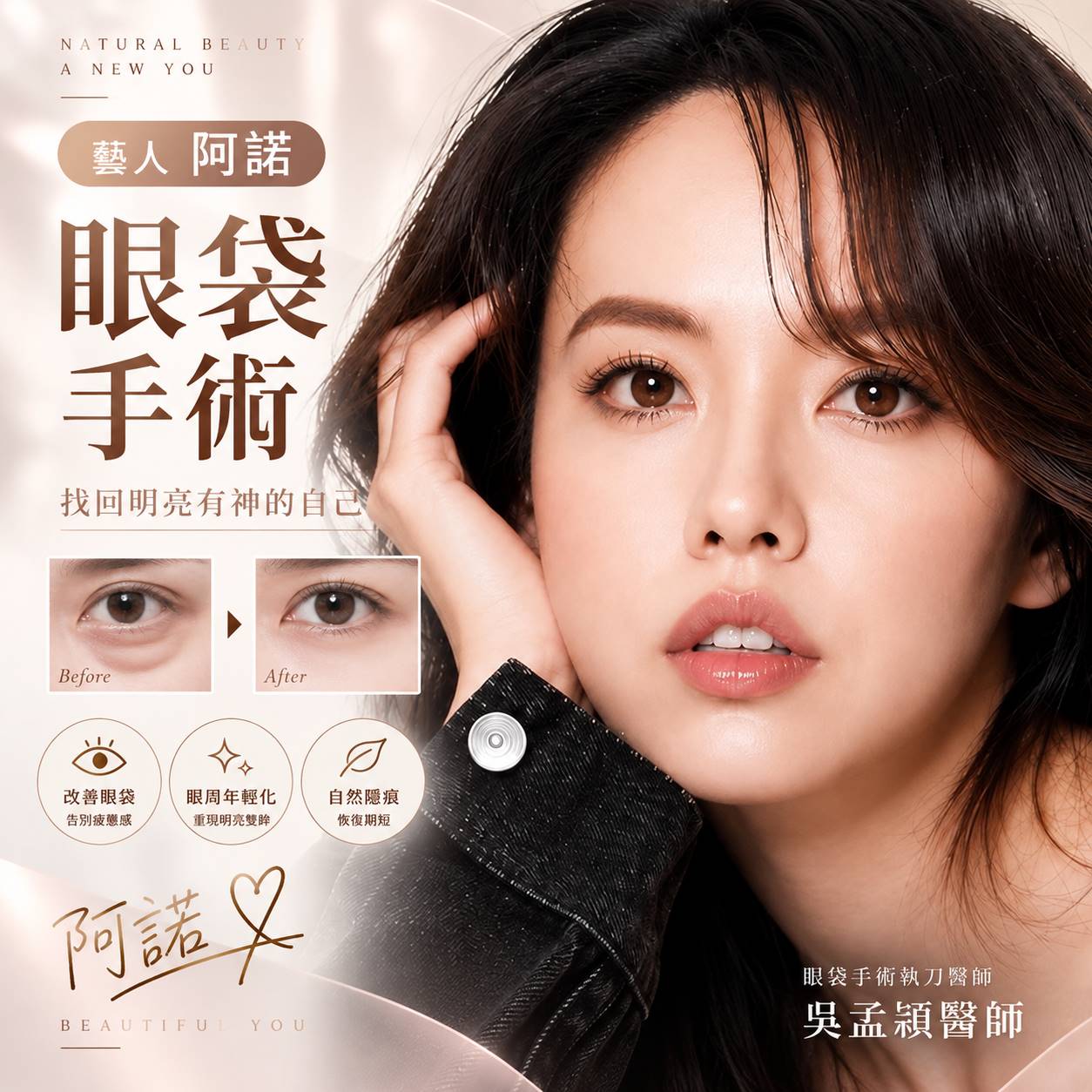 台北眼袋手術分為哪幾